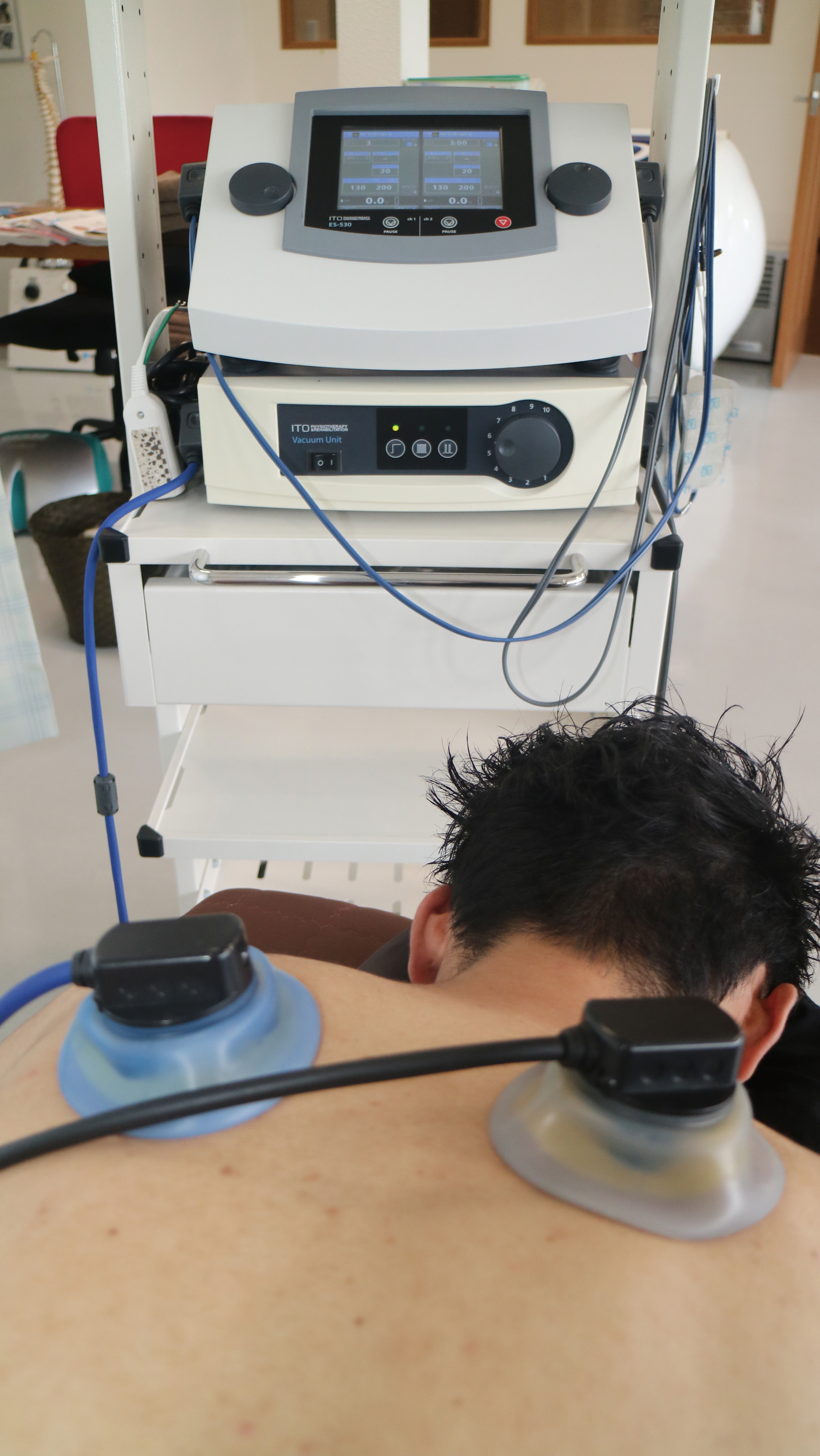 特殊電気治療についてのお話 豊橋の接骨院 豊橋の整体 鍼灸接骨院 腰痛 頭痛 肩こり 関節痛 エミシア鍼灸接骨院